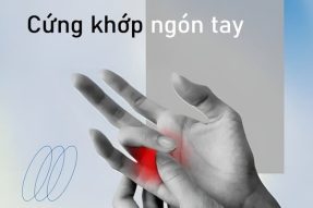 Lý do bị cứng khớp ngón tay và cách điều trị hiệu quả