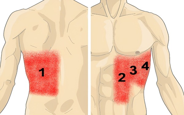 Nguyên nhân gây đau nhói sườn trái dưới tim