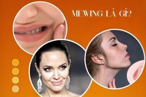 Mewing là gì? Trường hợp nên hay không nên tập Mewing