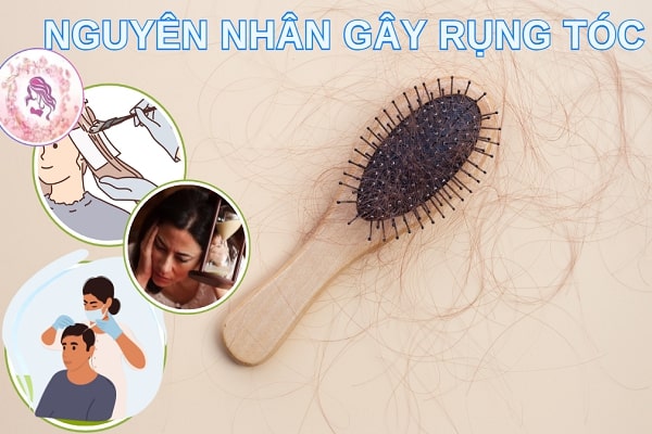 Một số nguyên nhân gây ra rụng tóc