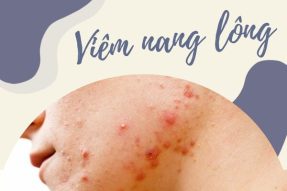 Viêm nang lông do đâu? Cách biện pháp phòng tránh hiệu quả