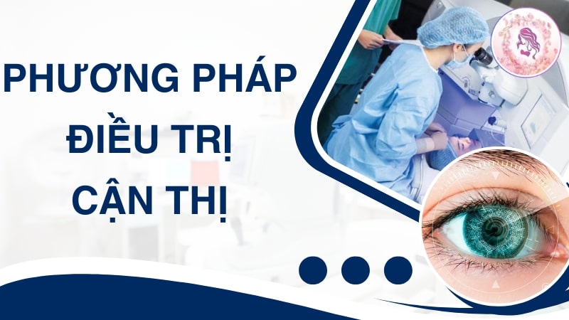 Cách điều trị tật cận thị khác